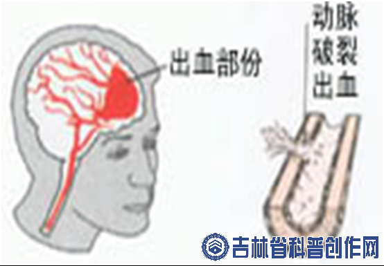 ����Ա��Ʒ����������ȷ��ʶ�Գ�Ѫ